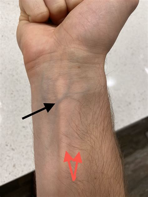 Questions About Veins In Wristwhy Are Some Bluegreen And On One
