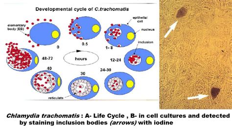Chalmydiae Introduction Morphology Life Cycle Pathogenecity Lab Diagn