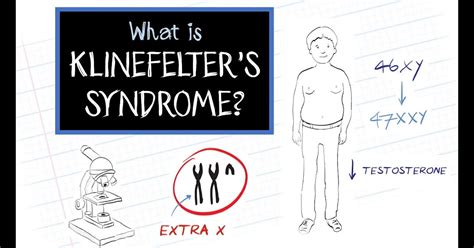 what is klinefelter s syndrome dorothy s list