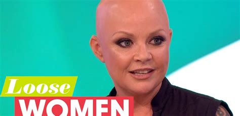 Gail Porter Female Model Tv Presenter Suffers Alopecia