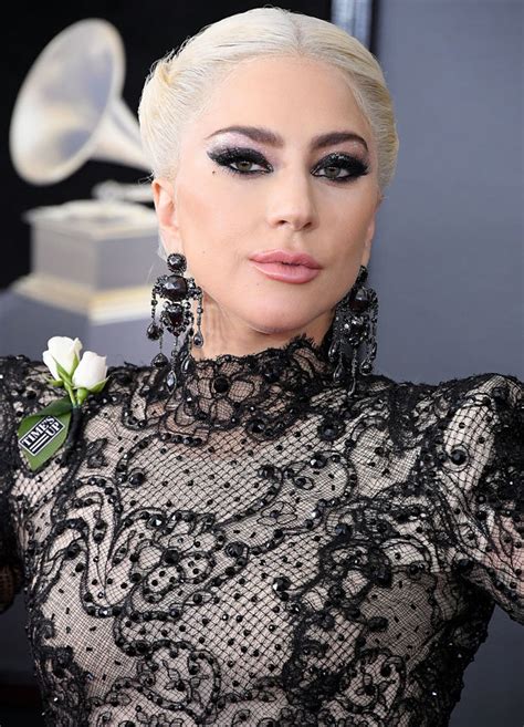 Lady Gaga Face Lift Plastic Surgeon Gives Verdict On Singers Dramatic