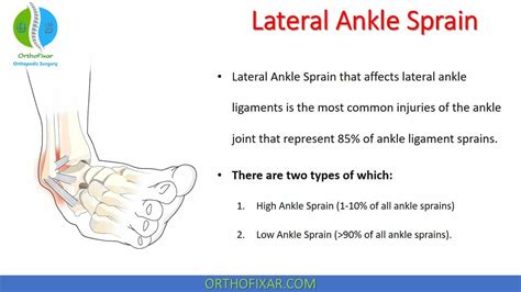 Lateral Ankle Sprain Orthofixar 2023