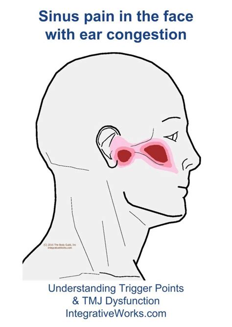 Pin On Sinus