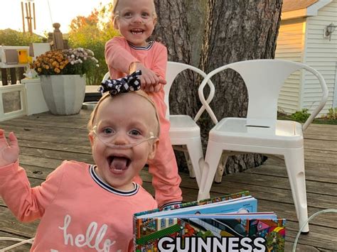 Worlds Most Premature Twins To Turn 2 In Iowa Guinness World Records