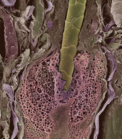 Hair Follicle Under Microscope - Micropedia