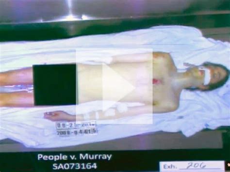 Las Fotos De La Autopsia De Michael Jackson Infobae Hot Sex Picture