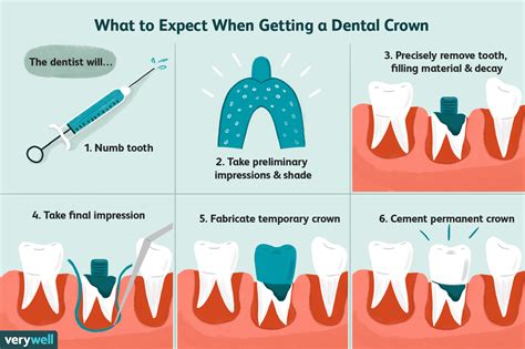 Getting A Dental Crown On Your Tooth