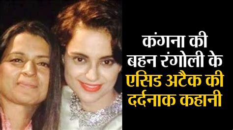 Watch Kangana Ranaut Sister Rangoli Acid Attack Story Youtube
