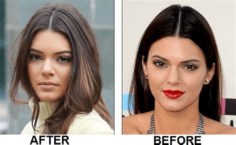 Venezuela Plastic Surgery Before And After
