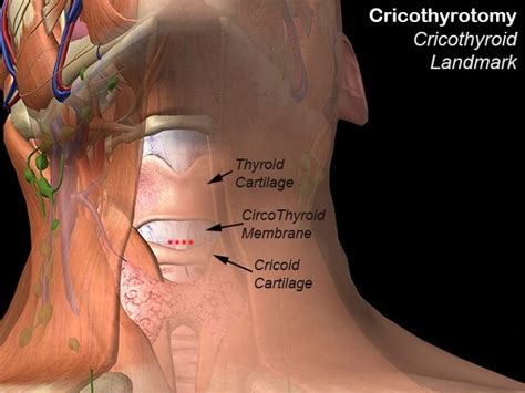 Cricoid Cartilage - Definition, Location, Function, Problems