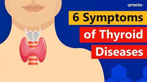 Hyperthyroidism And Symptoms For Hyperthyroidism What Is Thyroid In