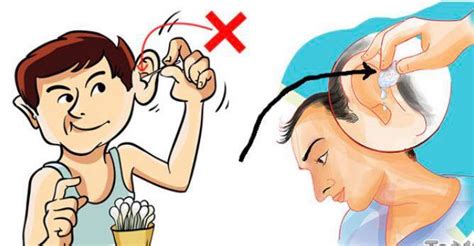 Telinga bernanah selalunya berpunca dari jangkitan kuman yang berlaku di bahagian dalam telinga. Tahi Telinga Keras, Tolong Ambil Tahu Punca Dan Cara Nak ...