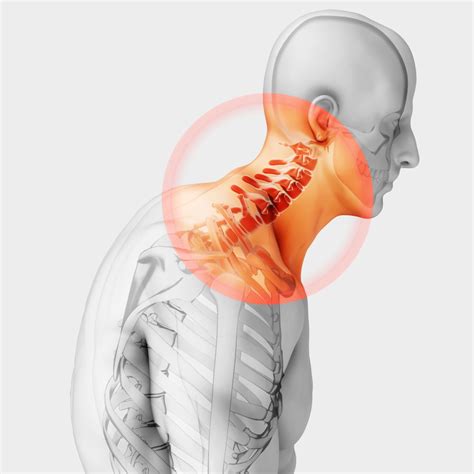 How To Get Rid Of Your Chronic Neck Pain Pandiculate
