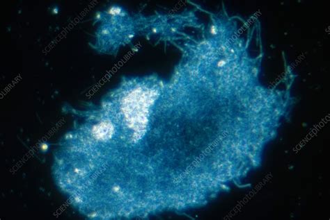 Lactobacillus Sp Bacteria Lm Stock Image C0121240 Science