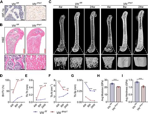 Frontiers Osteocytic Hif 1α Pathway Manipulates Bone Micro Structure