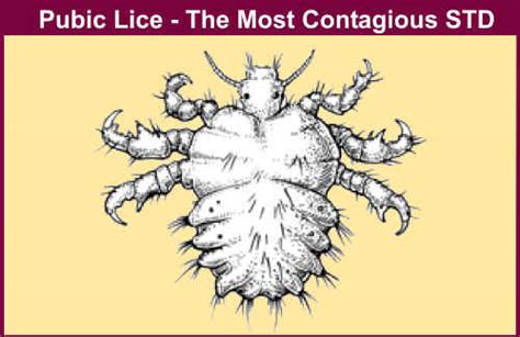 Pubic Lice Women Health Info Blog