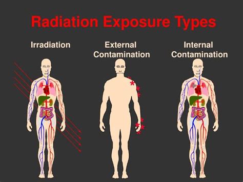 Radiation Uses And Hazards Of Ionising Radiation Teaching Resources