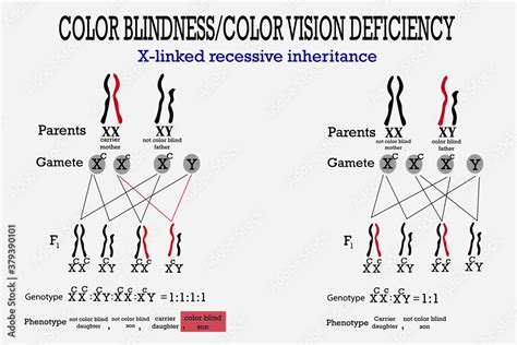Color Blindness Genetics On X Chromosome X Linked Gene Stock Vector
