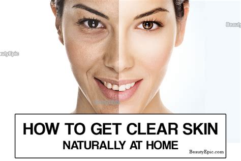 How To Get Clear Skin Naturally At Home ~