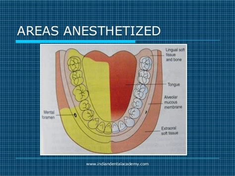 Akinosi And Gow Gates Nerve Blocks Prosthodontic Courses