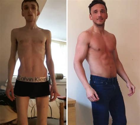 45 ‘before And After Photos Of People Who Beat Anorexia True Activist