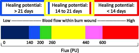 Insights Into The Use Of Thermography To Assess Burn Wound Healing