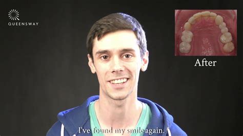 Matt Shares His Orthodontics And Dental Experience YouTube