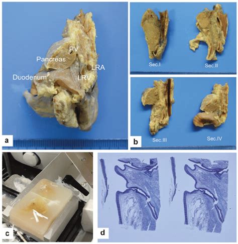 Preparation And Examination Of The Specimens A Sagittal Dissection