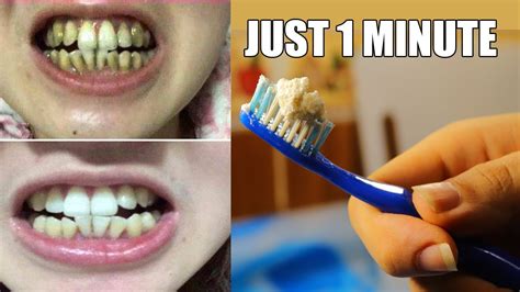 Whiten Teeth At Home Just 1 Minute How To Whiten Your Yellow Teeth