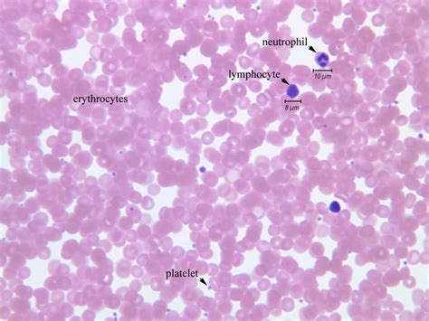 Light microscopy of cells labeled with itri iop light microscopy. labeled blood cells under microscope | blood label ...
