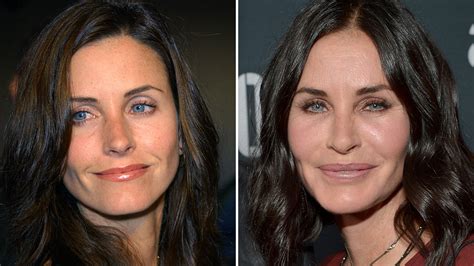 Courteney Cox ‘regrets Plastic Surgery Procedures Nbc Boston