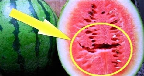 If You Open A Watermelon You Find These Cracks In It Do Not Eat It
