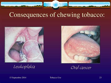 Ppt Tobacco Use Problems And Solutions Powerpoint Presentation Id