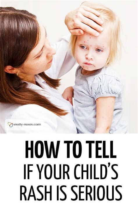 How To Tell If Your Childs Rash Is Serious A Great Guide To Childhood