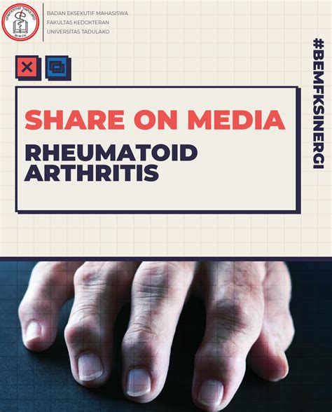 Rheumatoid Arthritis Bem Fk Untad