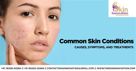 Knowing The Causes Symptoms And Treatments Of Common Skin Conditions