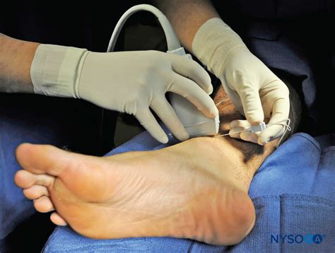 Regional Anesthesia Transducer Position And Needle Insertion To Nerve