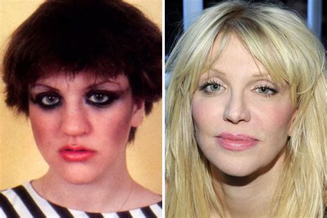 Courtney Love Natural To Plastic Nose Job Celebrity Plastic Surgery Celebs