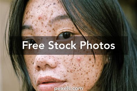 Spots On Face Photos Download The Best Free Spots On Face Stock Photos