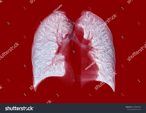 Ct Chest Lung 3d Rendering Image Stock Illustration 1699888381
