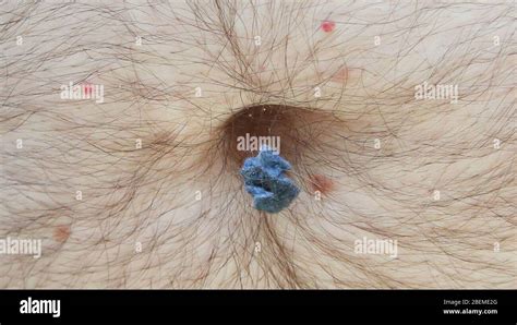 Man With Hairy Belly Removing Lint From His Navel Stock Photo Alamy