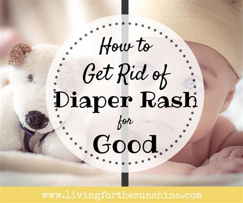 How To Get Rid Of Diaper Rash For Good Rash Treatment Diaper Rash