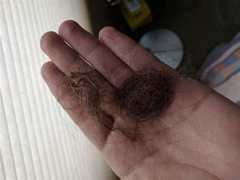 Pictures Of Normal Hair Loss In Shower JuseBeauty