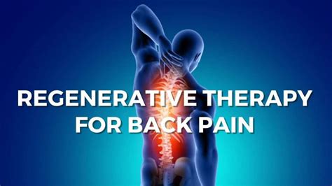 Could Regenerative Therapy Relieve Back Pain Pain Doctors Ny Pain
