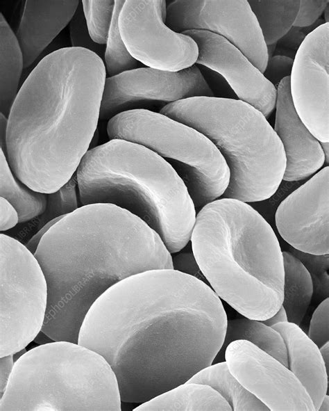 Human Red Blood Cells Sem Stock Image C0370700 Science Photo