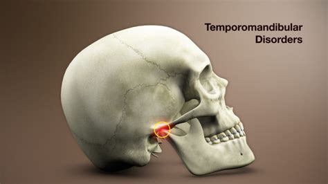 Temporomandibular Joint Disorder Symptoms Causes And Treatment