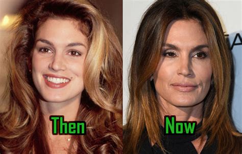 Cindy Crawford Plastic Surgery Is Her Beauty Secret Before After
