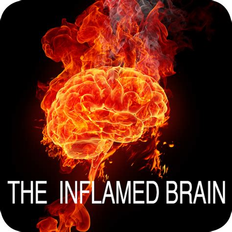 The Inflamed Brain Rachel Arthur Nutrition