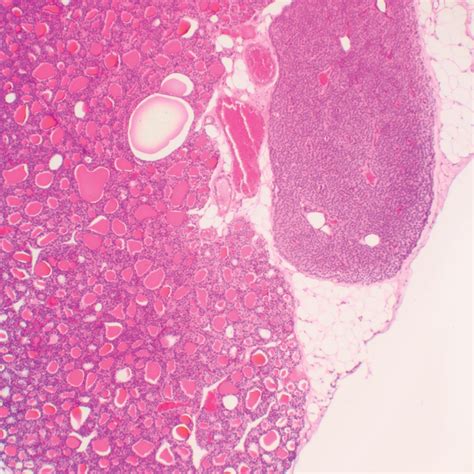 Mammal Thyroid Gland And Parathyroid Gland Sec 7 µm Hande Microscope