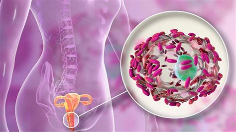 ¿qué Es La Vaginosis Bacteriana Síntomas Causas Y Cómo Tratar La Enfermedad